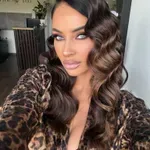 Otišla sam na vreme i otkrila bolest u početnoj fazi: Katarina Živković o dijagnozi koja je promenila sve