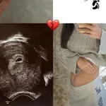 Znan slovenski par sporočil tragično novico, izgubila sta otroka