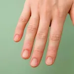 Ali veste, kateri so prvi simptomi raka, ki se najprej kažejo na rokah?