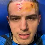 "Heroj" Krstović pokazao rane: Atalanti je trebao centarfor stare...