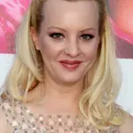 Propustila Oskar zbog estetske operacije