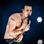 Yungblud slomio nogu, ali nastavlja turneju