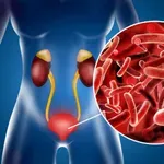 Izjemne koristi D-manoze ob okužbah sečil in genetskih motnjah