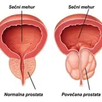 Naravni zeliščni trojček za moško moč in zdravo prostato
