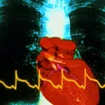 Te drobne spremembe močno zmanjšajo tveganje za srčni infarkt