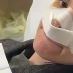 Srbska pevka s polovico obraza v povojih: "Uničili so mi nos"