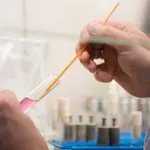 Smrtonosna gliva se nezadržno širi, smrtnost je visoka