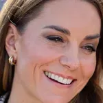Princesa Kate ima nove zobe