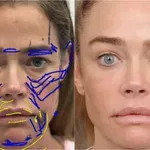 Fotografije Deniz Ričards otkrivaju realnost fejsliftinga